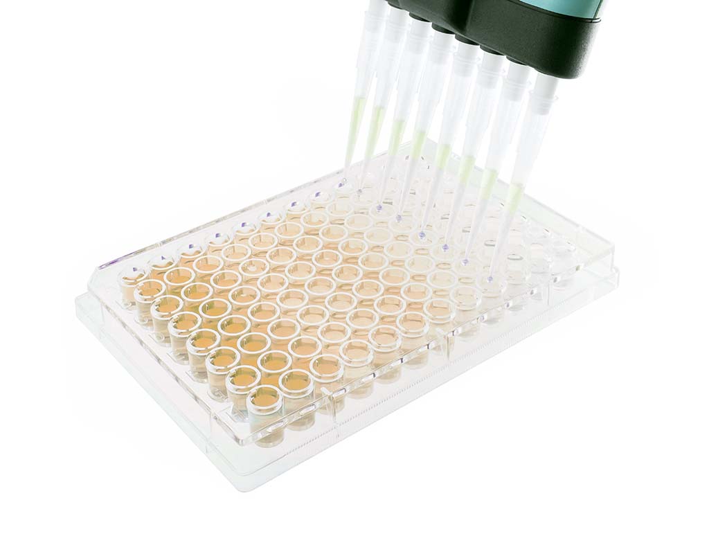 Microplate with elastin labelled with Biocolor Fastin assay kit