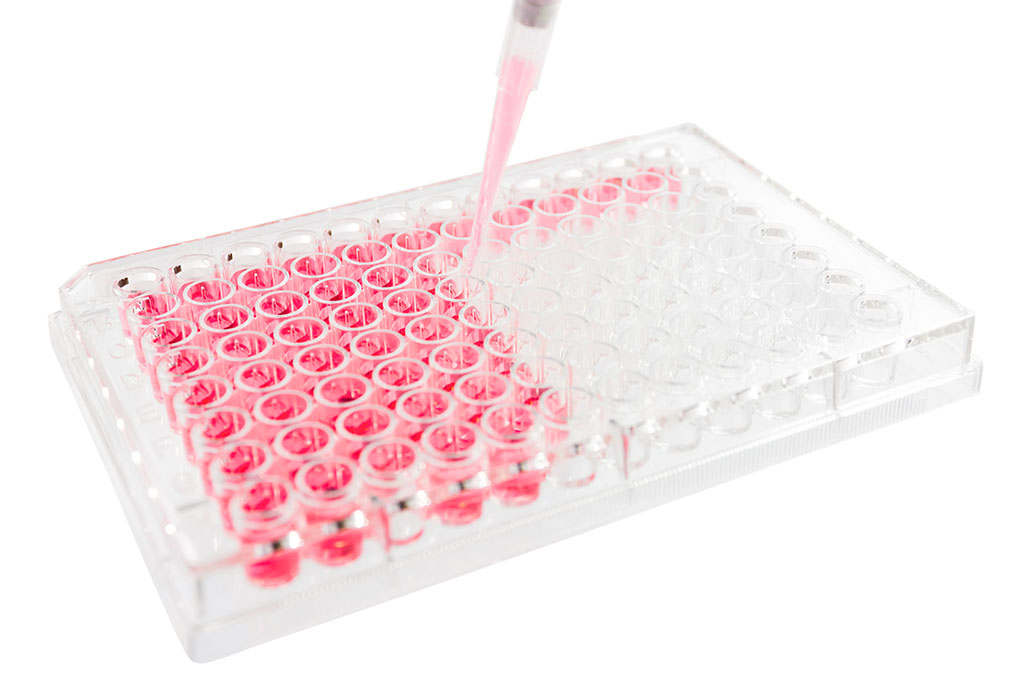 Sircol dye released from Insoluble collagen in Biocolor's Sircol assay kit