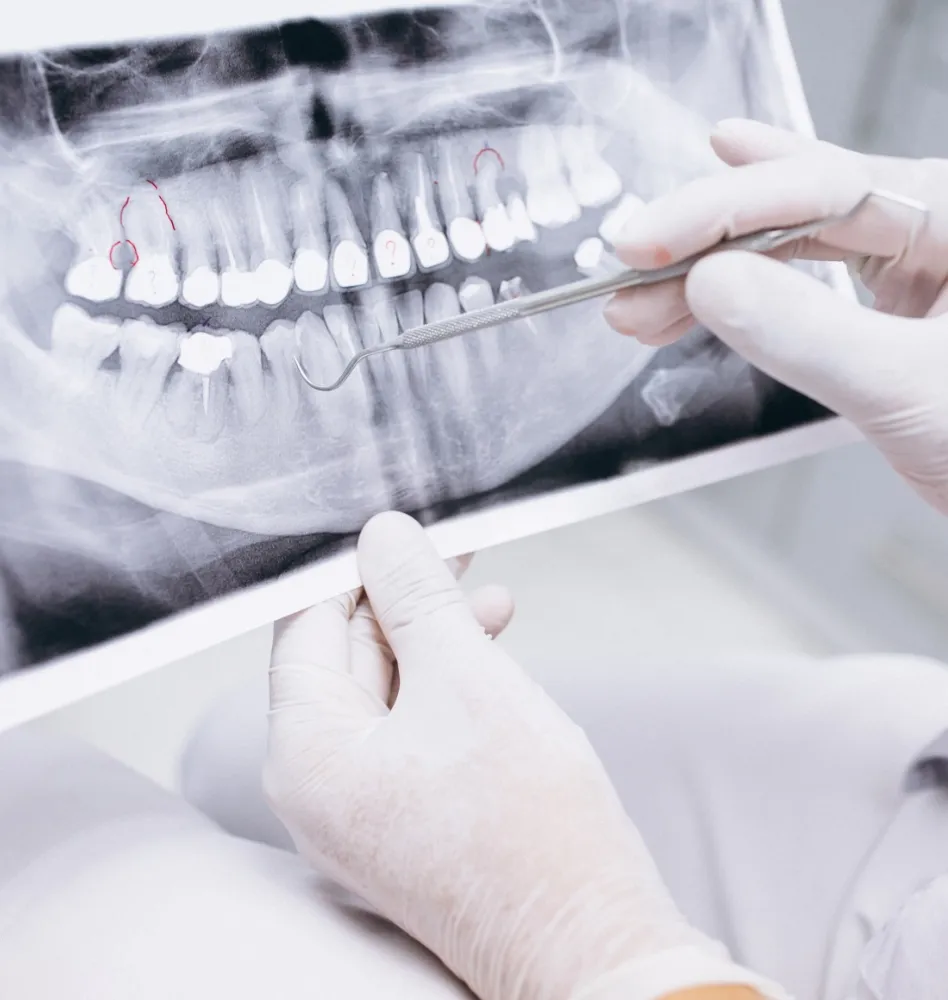 Manos sosteniendo radiografía