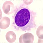 tricholeucocyte