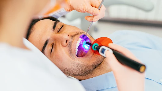 Dentist using a blue UV curing light and dental mirror to perform a procedure on a male patient in a bright, clinical dental office.