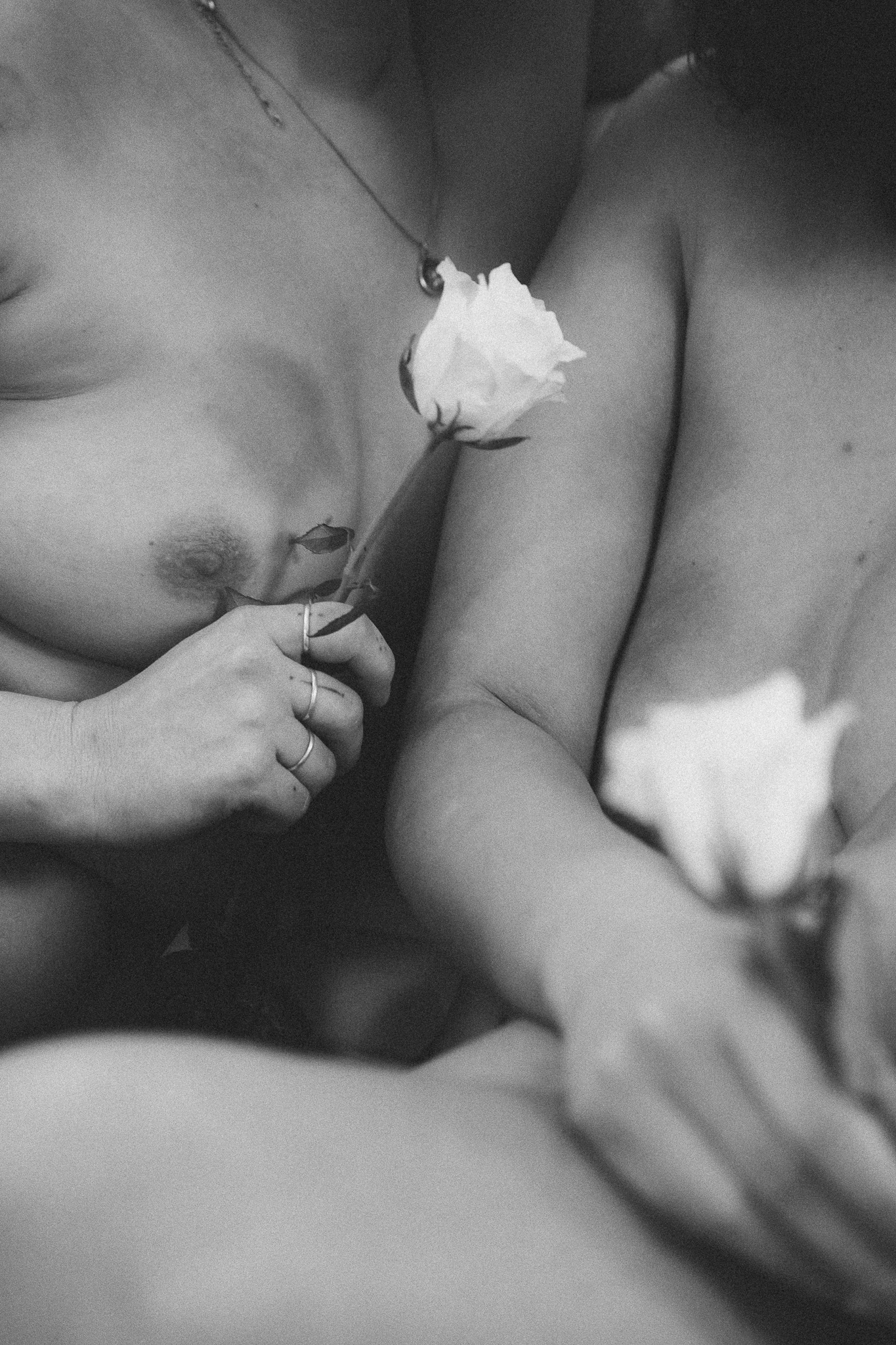 Scars are beautifullll