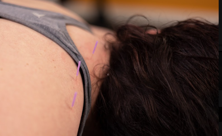 Athlete completing a guided rehabilitation exercise at a physical therapy clinic.