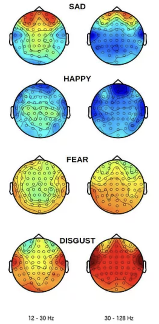The brain with differently colored areas.