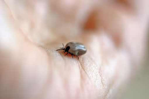 What are the Signs of Lyme Disease?