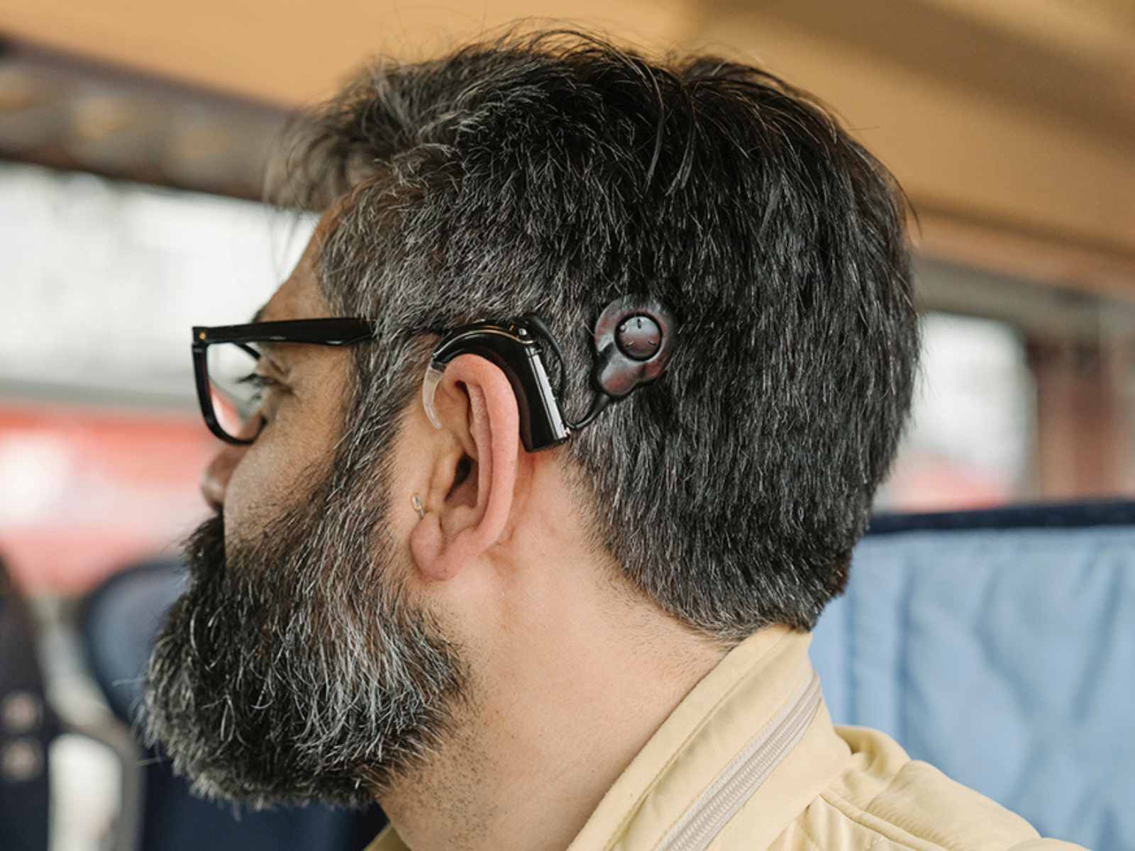 Cochlear Implant Costs: What You Need to Know