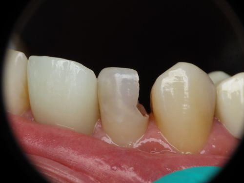 before and after treatment