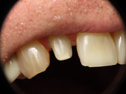 before and after treatment