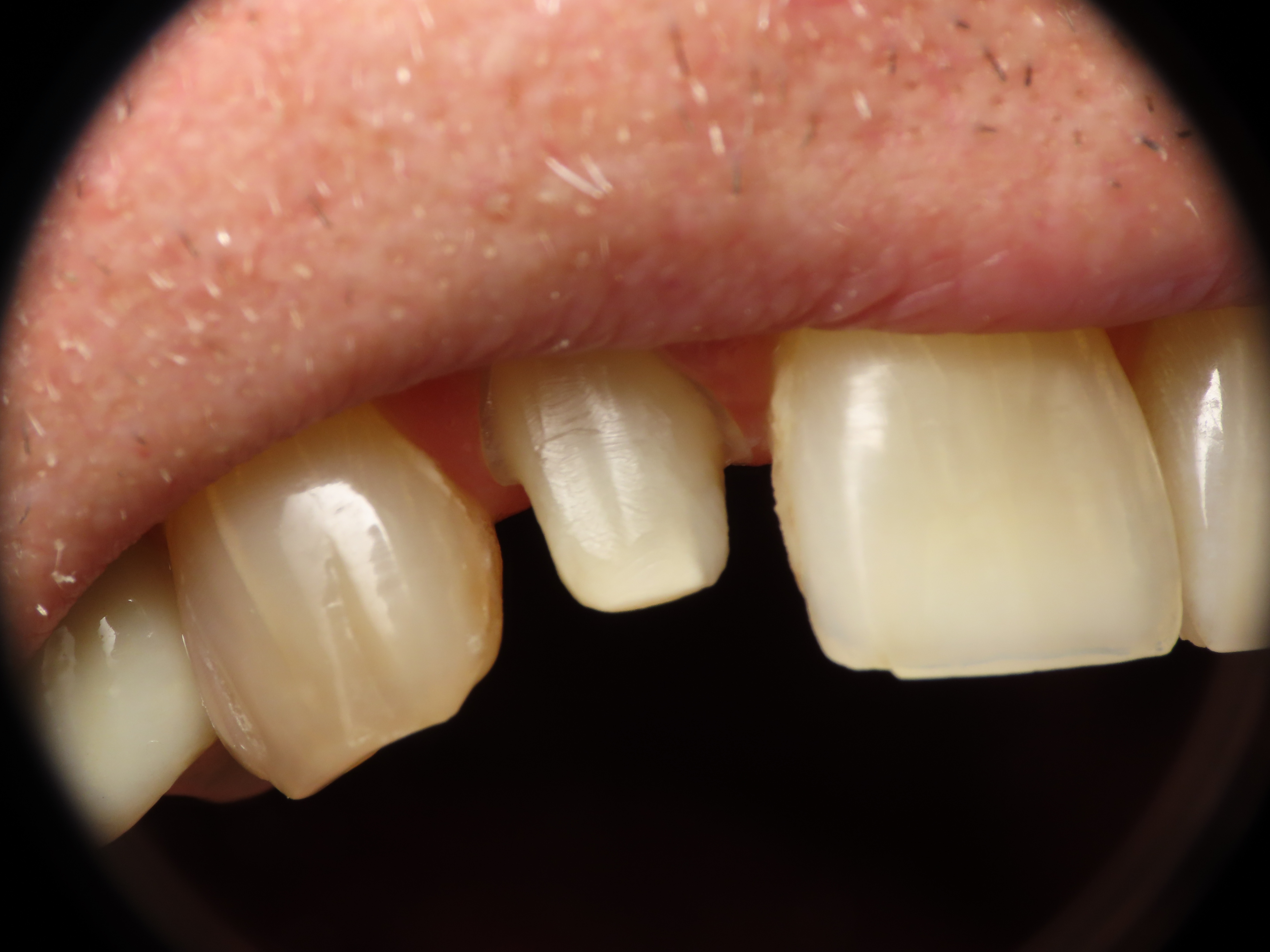 before and after treatment