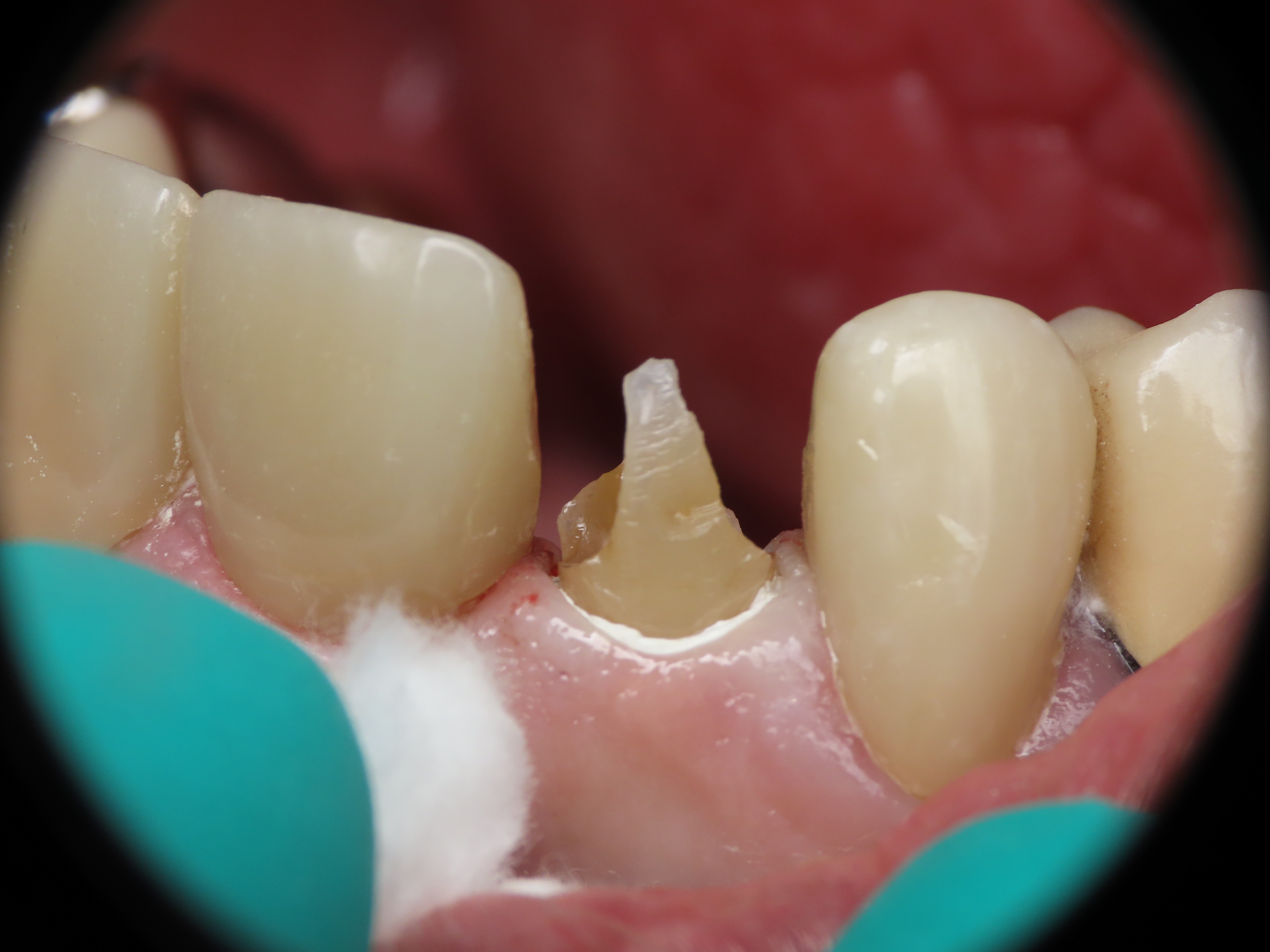 before and after treatment