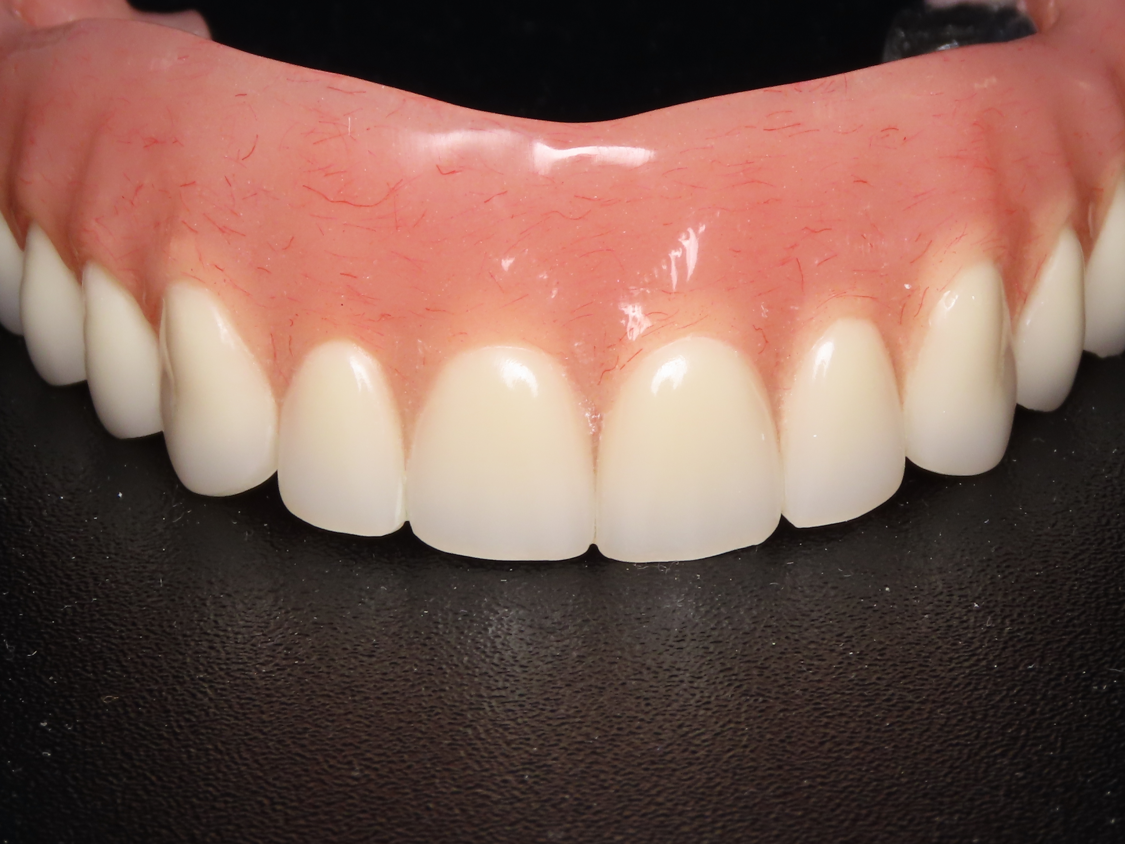 before and after treatment