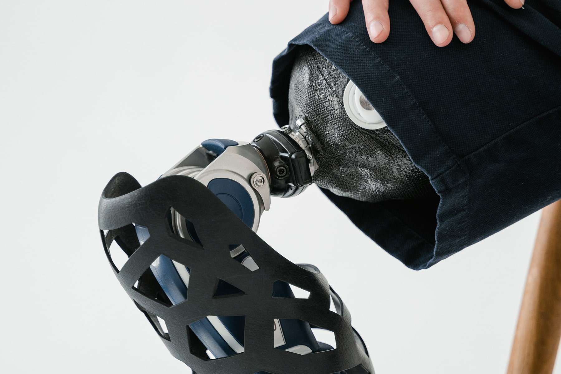 COMPUTERTOMOGRAPHIE UND MAGNETRESONANZTOMOGRAPHIE BEI PROTHESEN