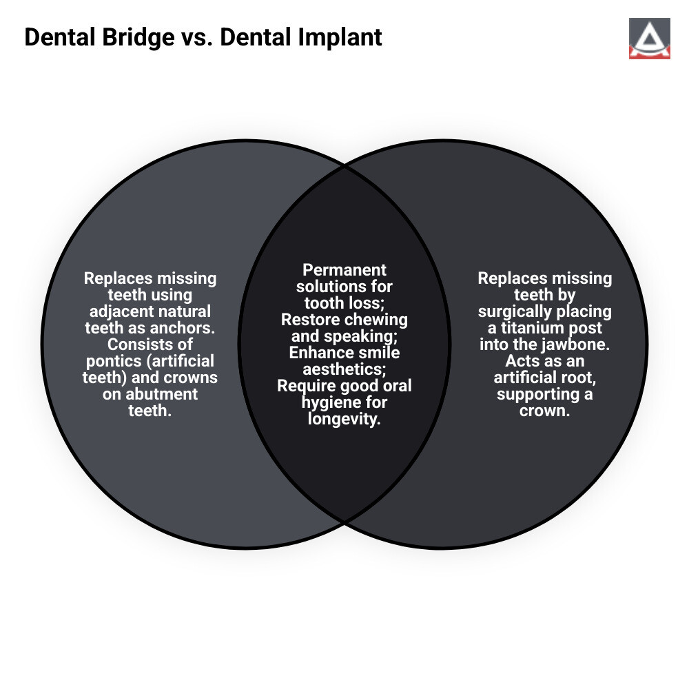 Infographic explaining the structure of a dental bridge vs. a dental implant - broken bridge teeth infographic venn_diagram