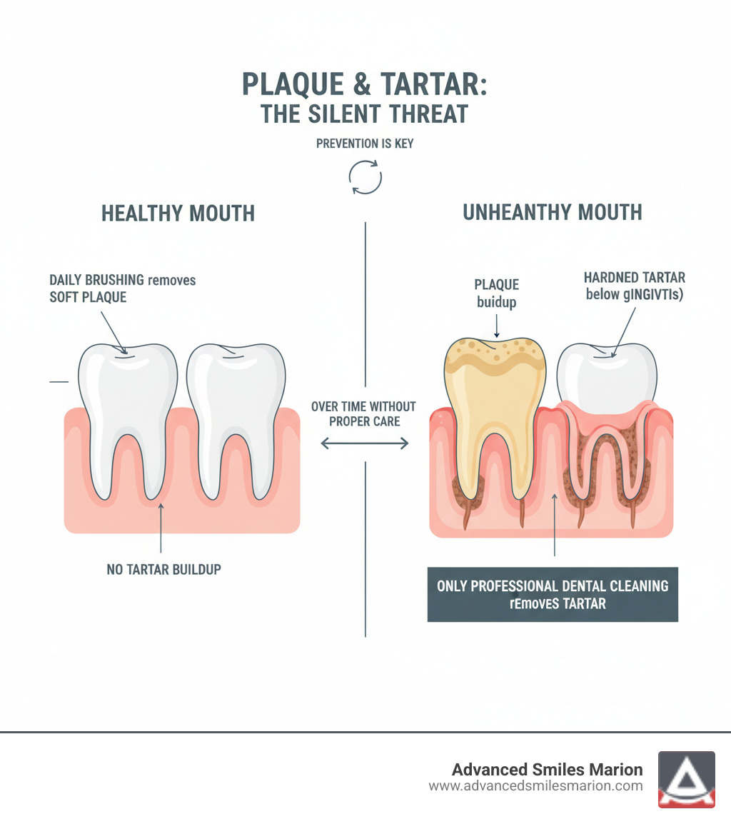 Infographic showing the buildup of plaque on teeth surface that hardens into tartar below the gum line, with labels indicating that daily brushing removes plaque but only professional dental cleaning can remove hardened tartar, plus visual comparison of healthy gums versus inflamed gums affected by tartar buildup - teeth cleaning rate infographic 
