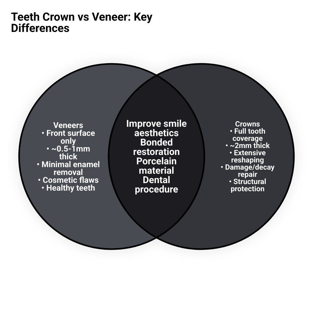 Infographic comparing veneer front-surface coverage vs full crown encapsulation of a tooth - teeth crown vs veneer
