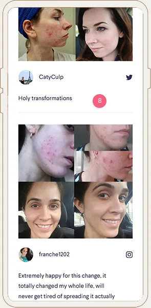 Curology PPC Landing Page