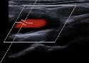 Ultraschall