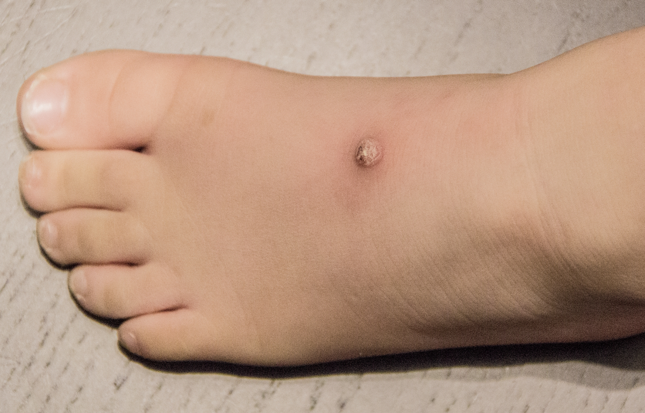 Podiatric Dermatology