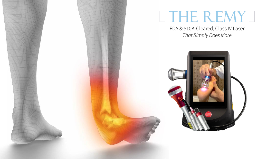 Musculoskeletal Laser Therapy