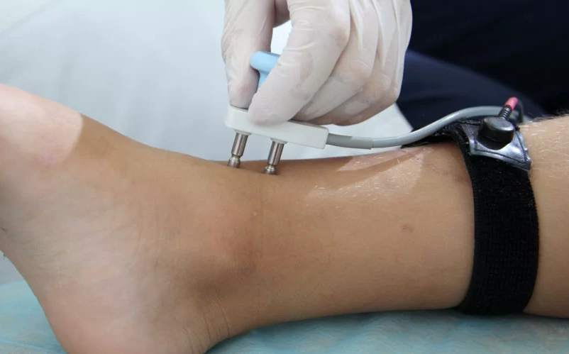 EMG and NCV Studies