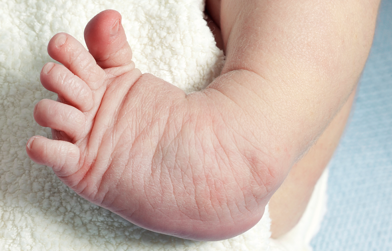 Pediatric Podiatry