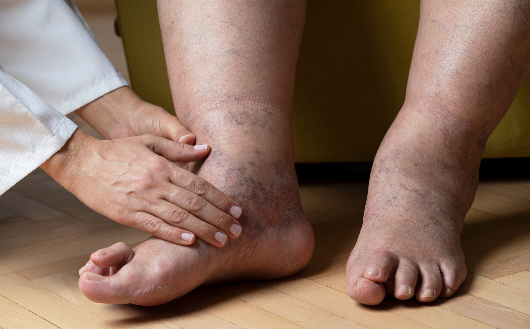 Diabetic Foot Care