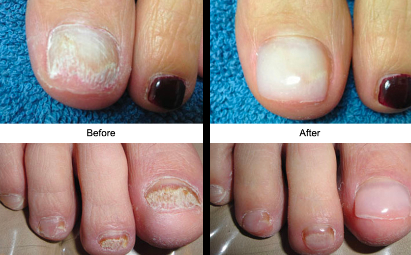 Medical Pedicures