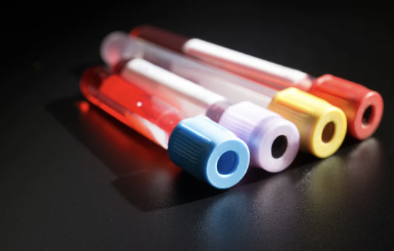 What Does a Phlebotomy Technician Actually Do All Day?