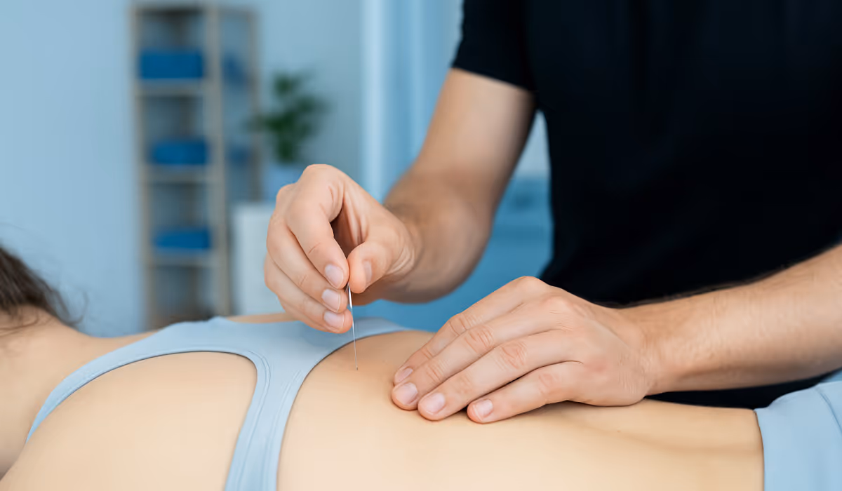 Waarom kiezen voor dry needling bij spierklachten?