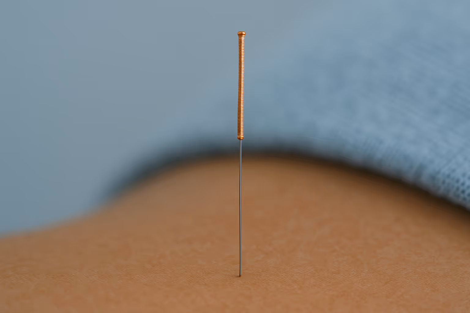 Close-up van een acupunctuurnaald met koperen handvat, voorzichtig geplaatst in de huid, met een zachte lichtblauwe achtergrond en kalme sfeer.