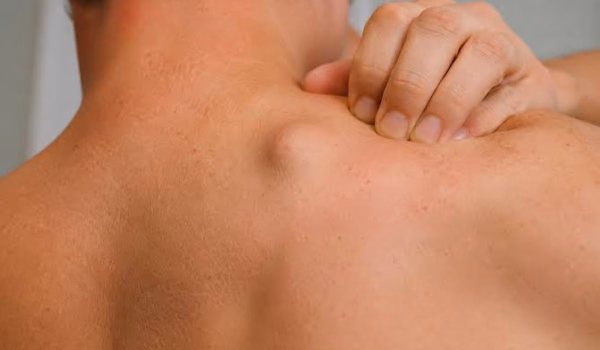 Onderhuidse bultjes en knobbels in je spieren: wat zijn ze precies?