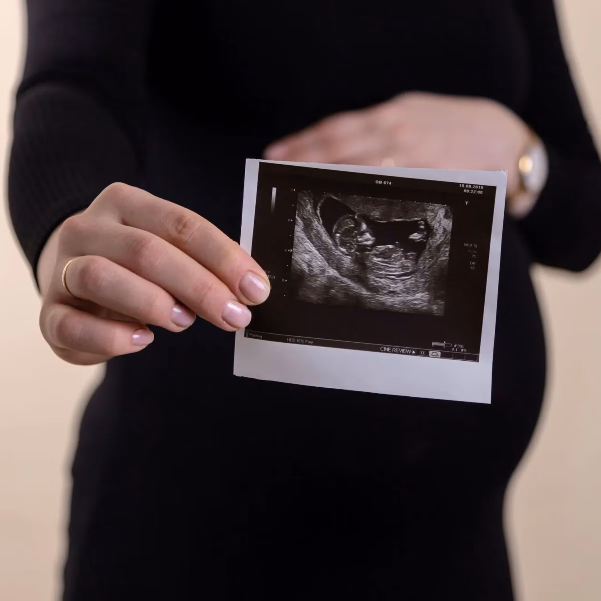 Obstetrics 