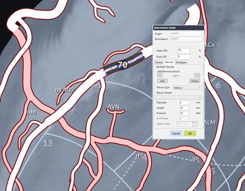 Extensive data capturing abilities for the latest interventional procedures.