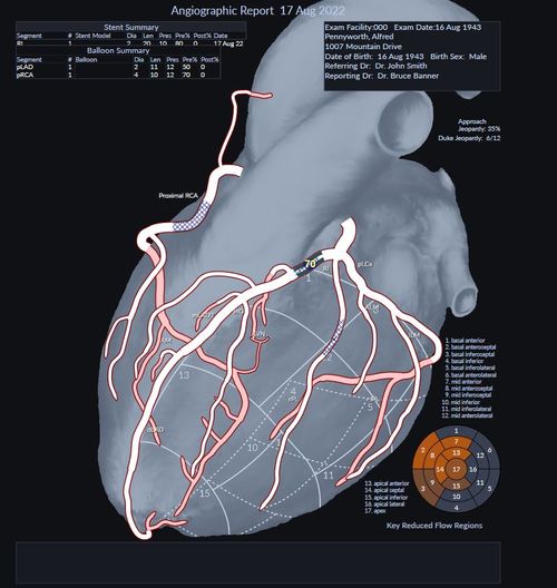 Showing CARAT's ability to generate reports on grafts, stents, and calculate risk scores.