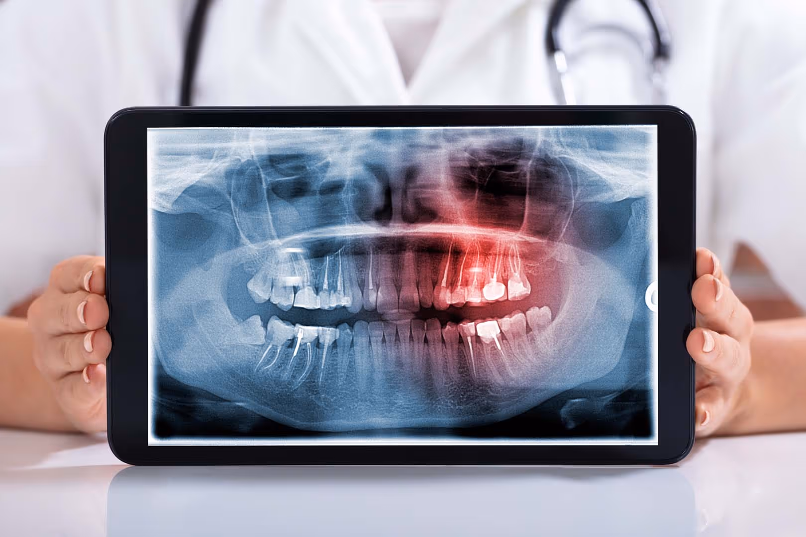 What Are Digital X-Rays?