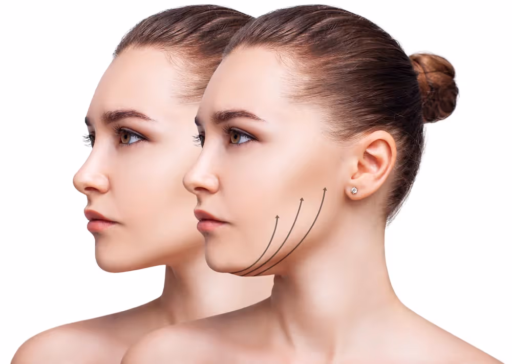 Facial Feminization Surgery (FFS)