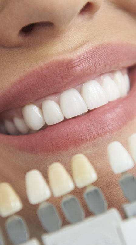 Krause: Gallery Image 03