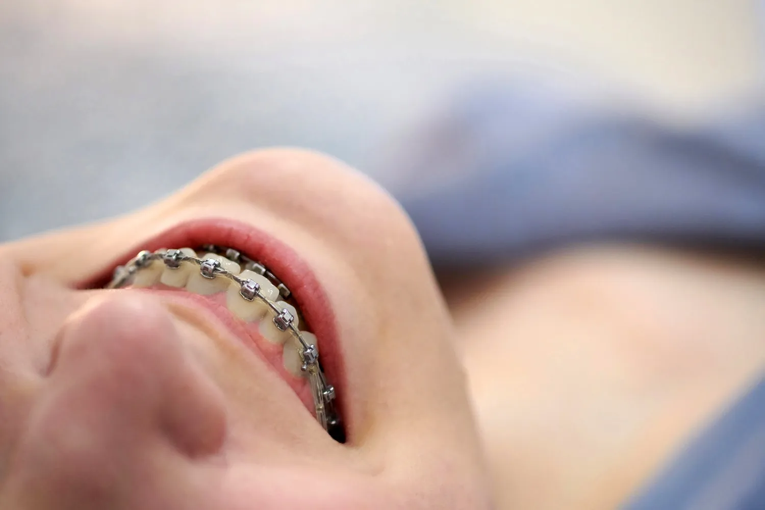 Bryn Mawr Orthodontics Blog