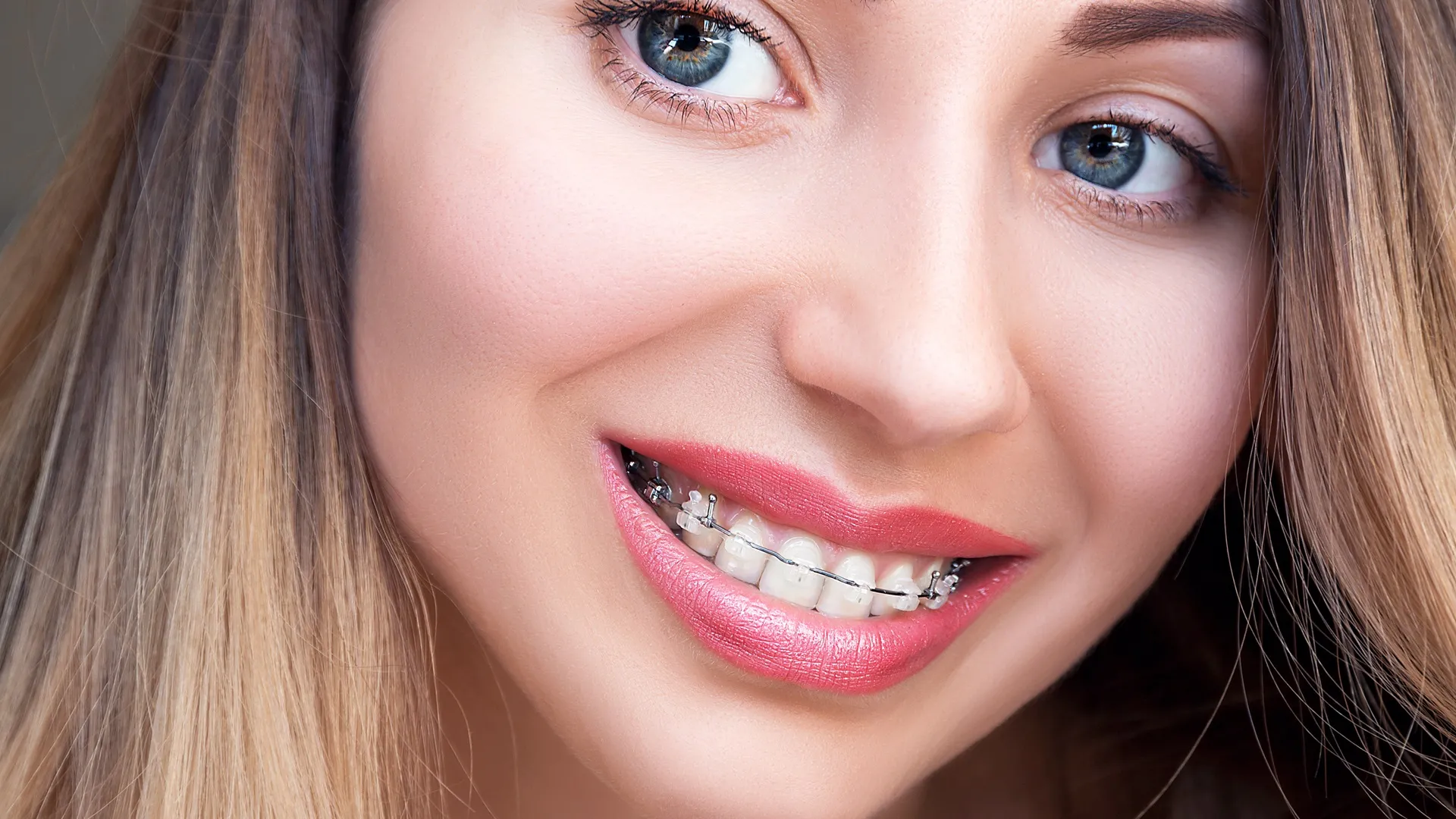 Bryn Mawr Orthodontics Blog