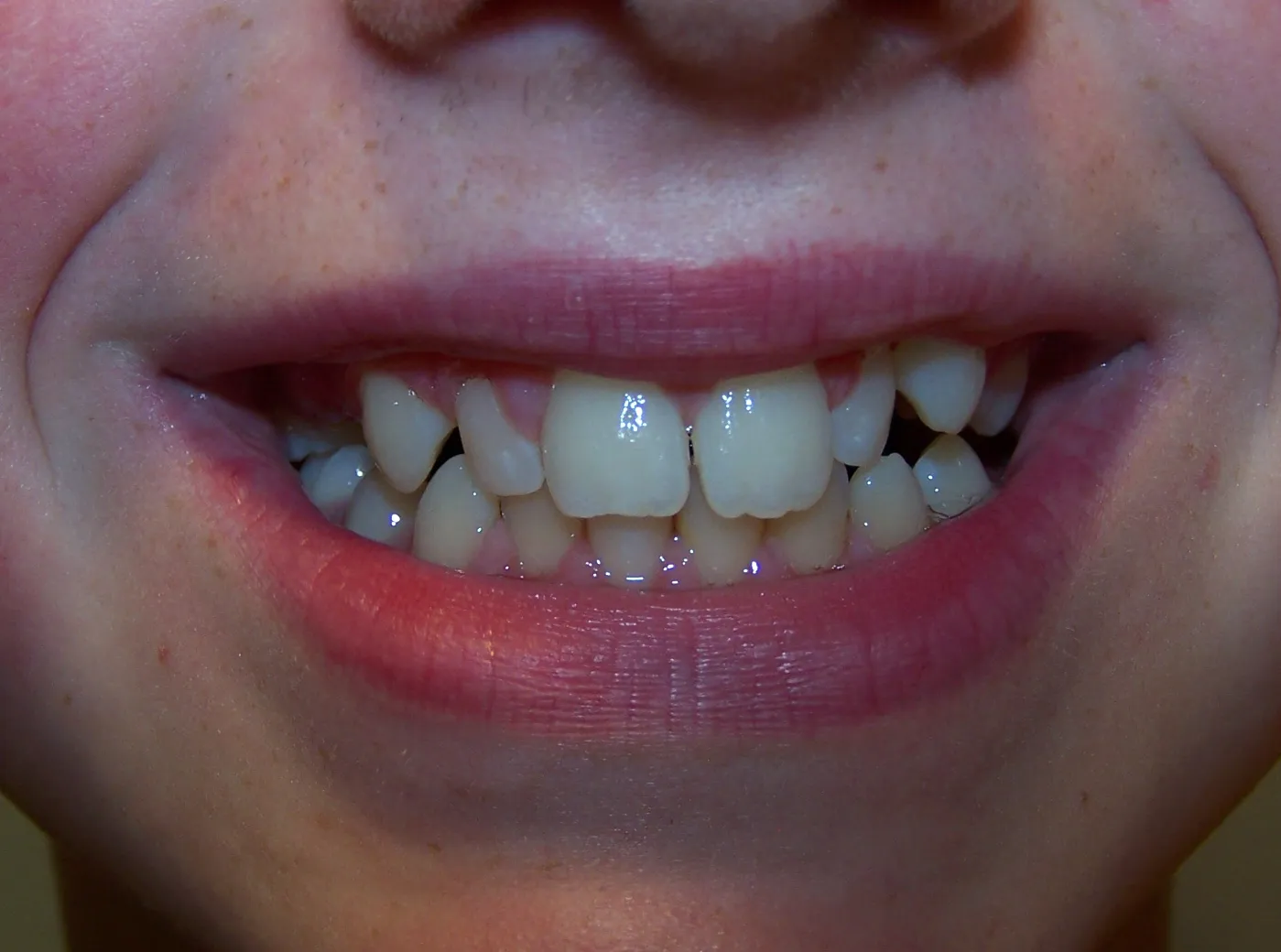 before and after treatment