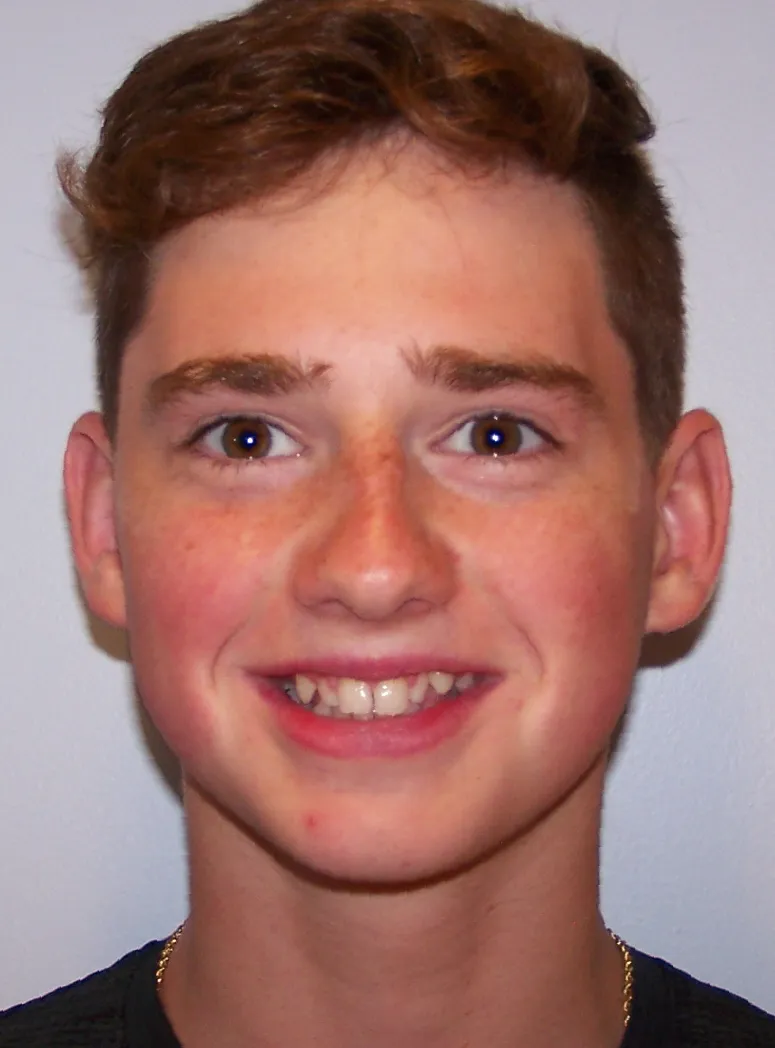 before and after treatment