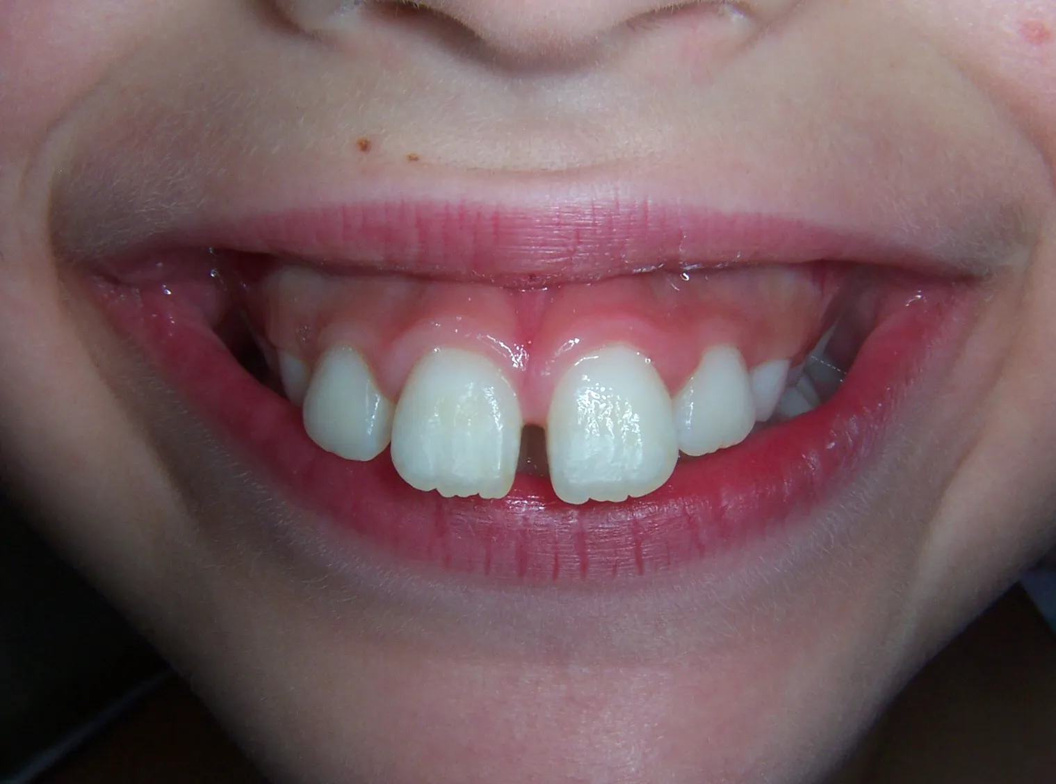 before and after treatment