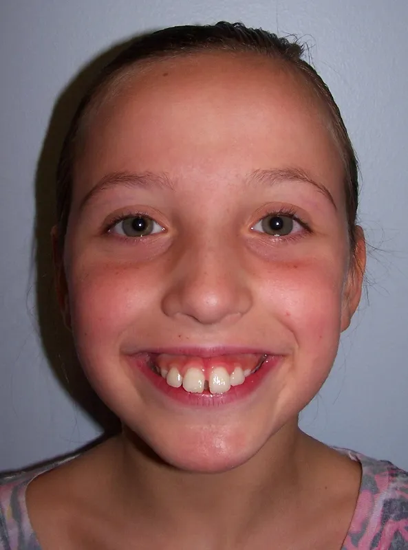 before and after treatment