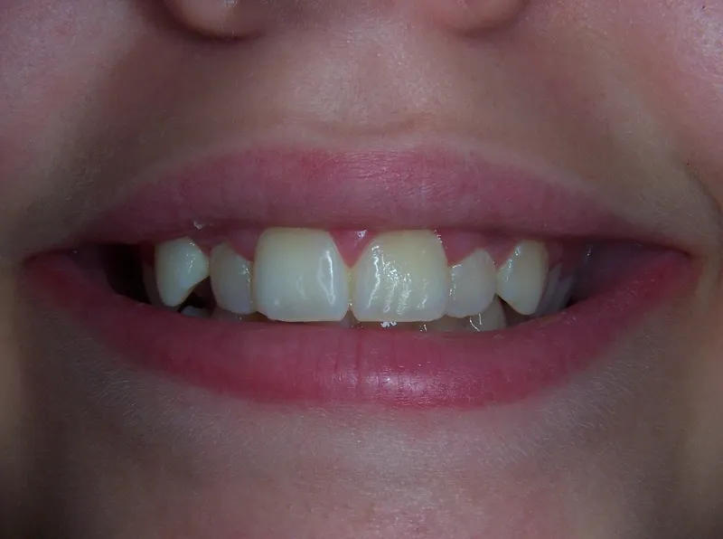 before and after treatment