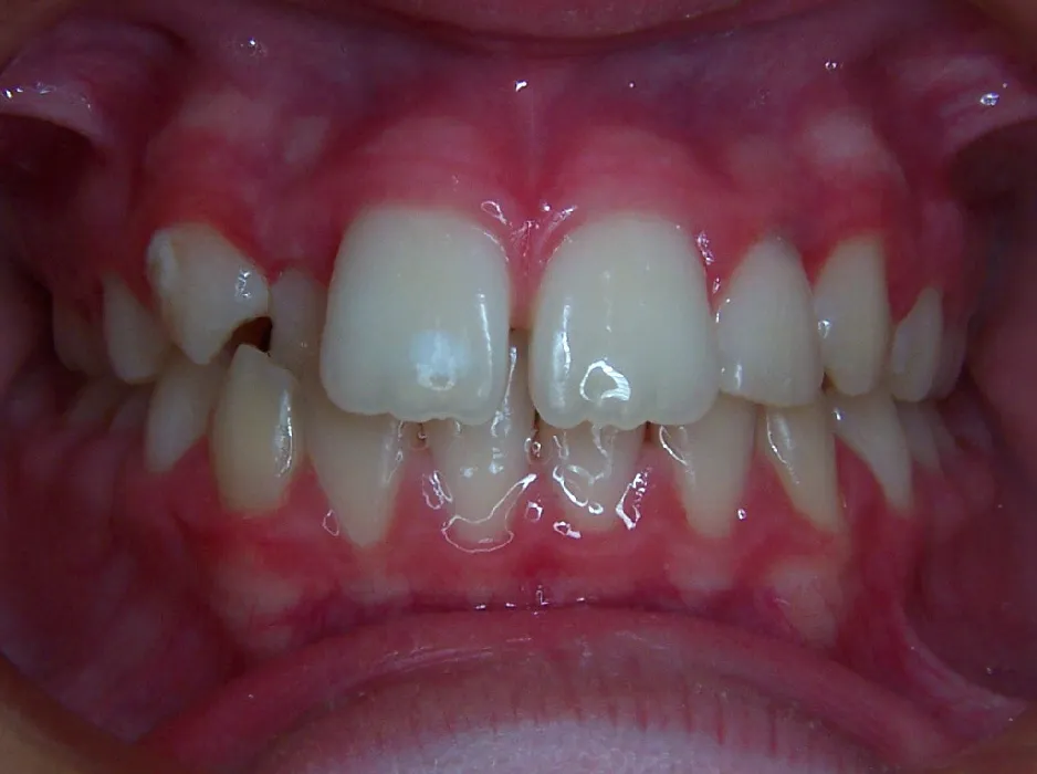 before and after treatment