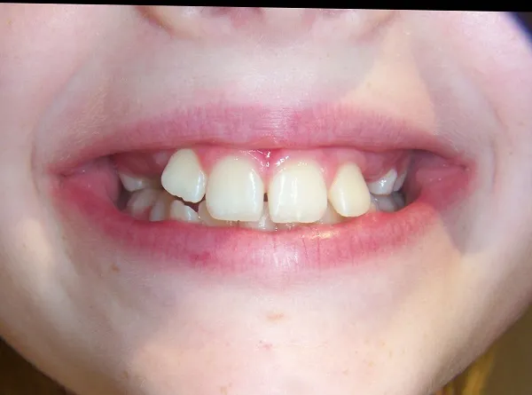 before and after treatment