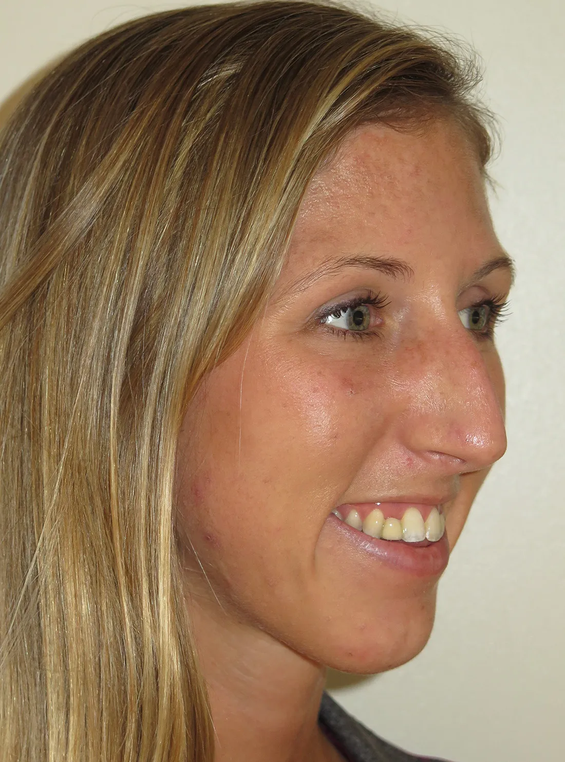 before and after treatment