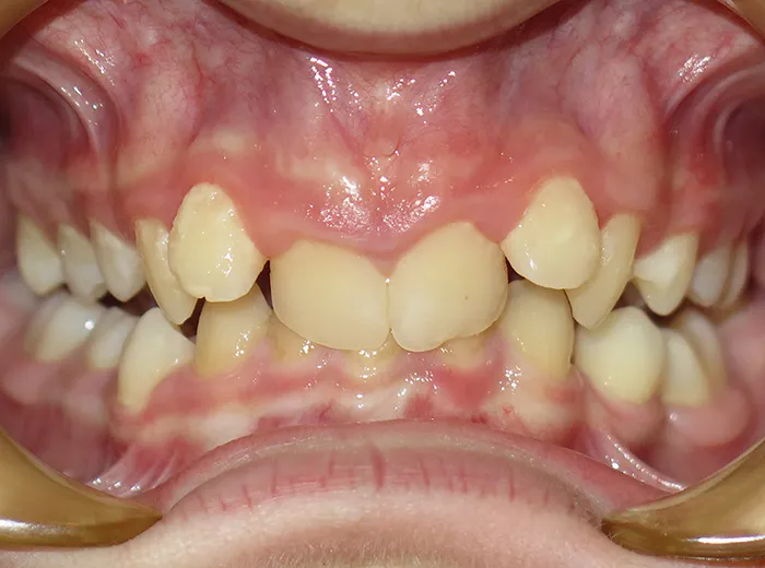 before and after treatment