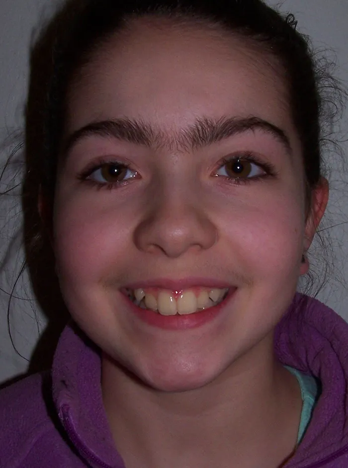 before and after treatment