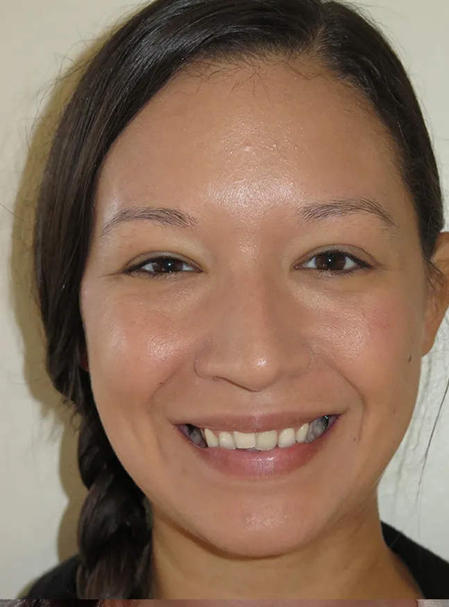 before and after treatment